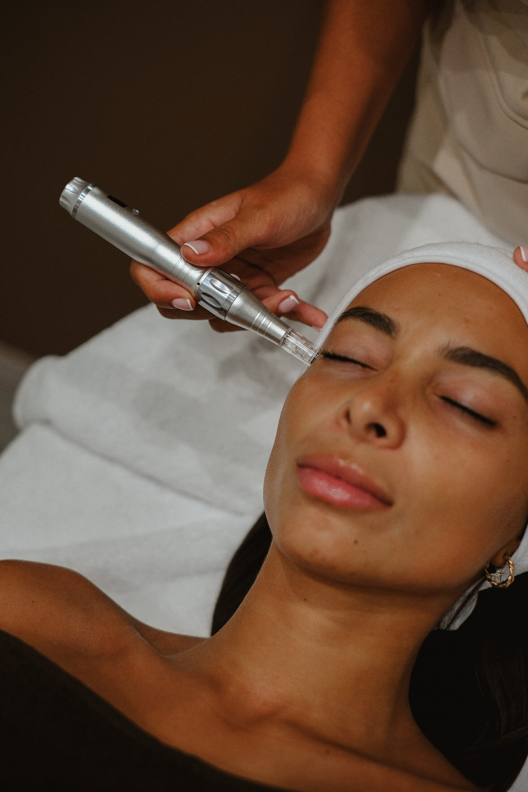 Exosomas con Dermapen